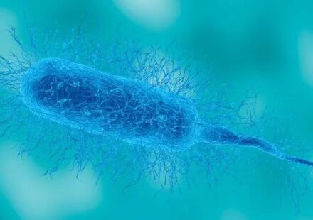 Florida health officials warn after first Vibrio death of 2026